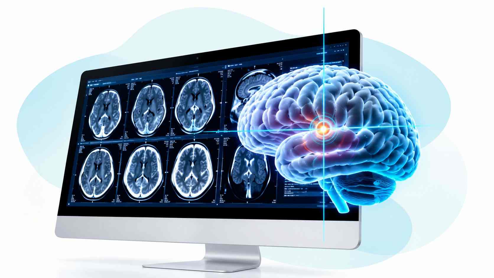 Neuronavigation 3D image-guided localization